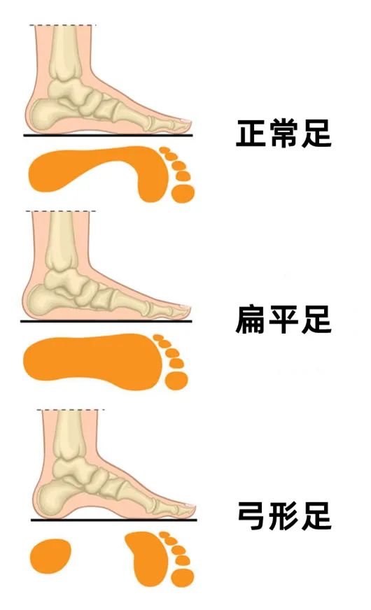 如何判断脚上痣的最佳位置 (如何判断脚上是湿疹还是脚气)